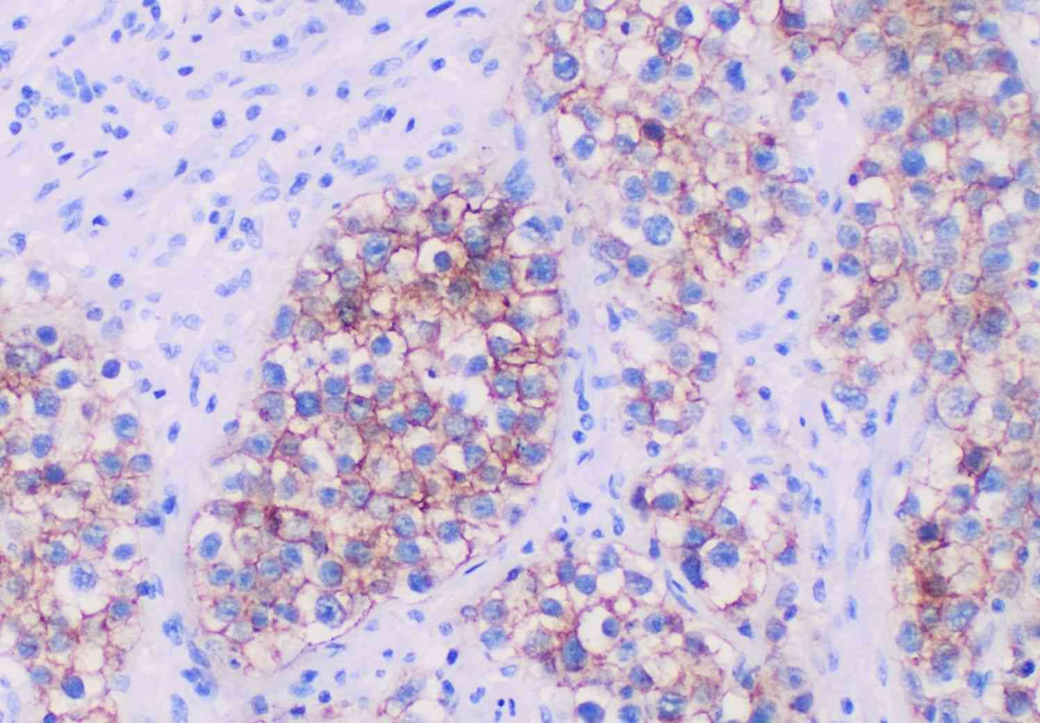 Fig.3 Primary cultures for IHC-viability assays. (By Mikael Häggström, M.D. - Own work, CC0, https://commons.wikimedia.org/wiki/File:Positive_CD117_immunohistochemistry_in_seminoma.jpg)