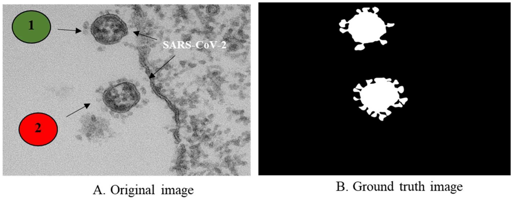 Fig.3 Morphometry of SARS-CoV-2. (Taha, et al., 2022)