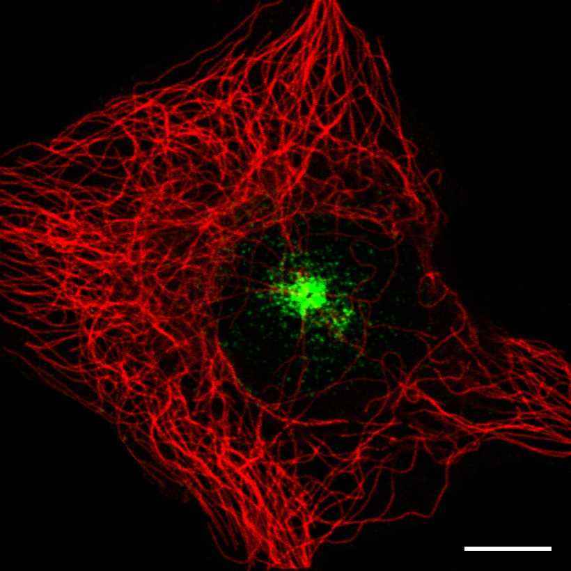 Fig.10 Microtubule organizing center. (https://v15.proteinatlas.org/learn/dictionary/cell/centrosome+(microtubule-organizing+center))