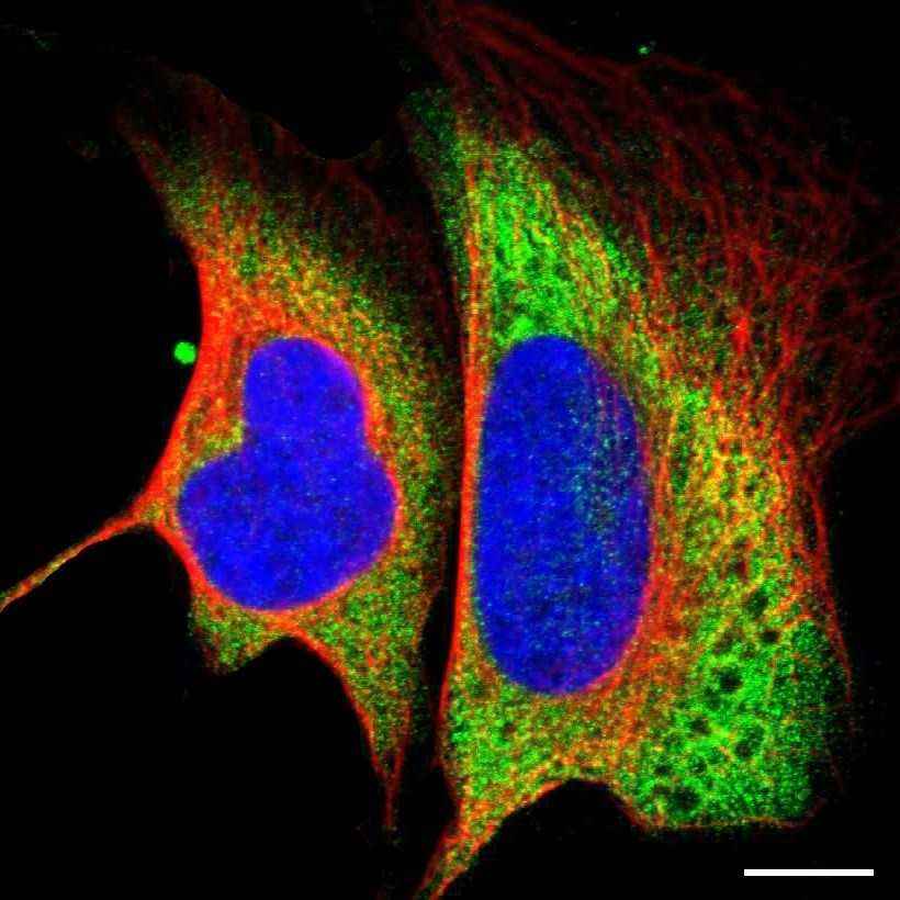 Fig.14 Cytosol. (https://v18.proteinatlas.org/learn/dictionary/cell/cytosol+4)