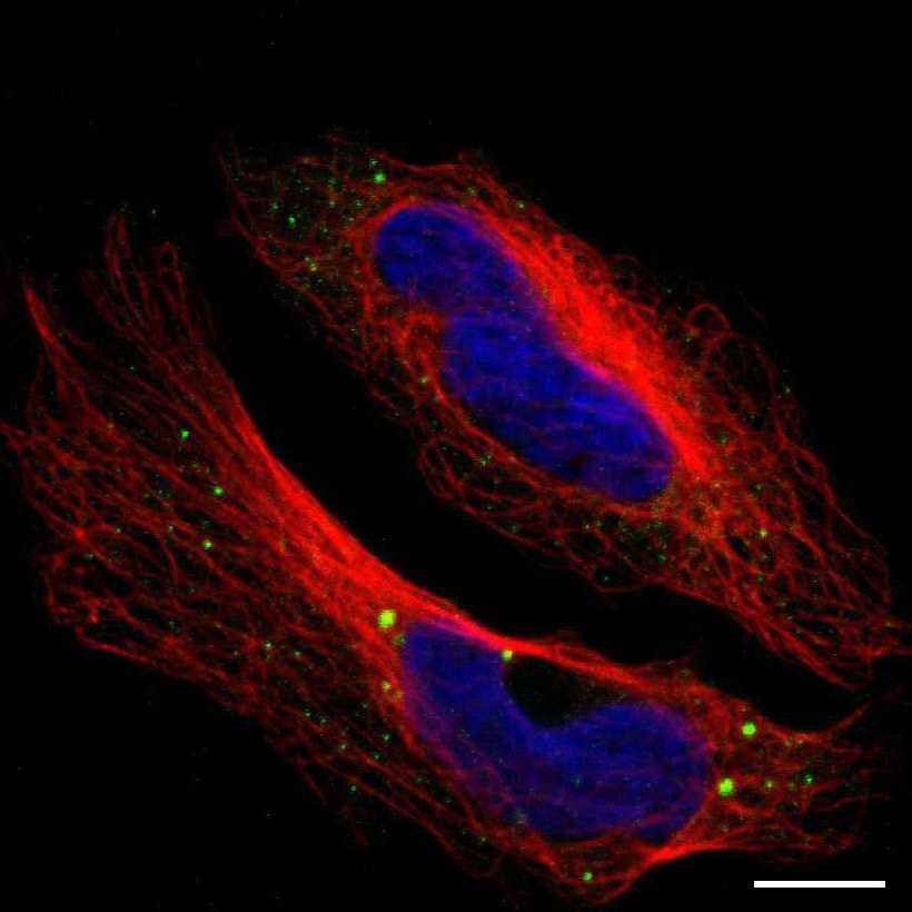 Fig.15 Cytoplasmic bodies. (https://v18.proteinatlas.org/learn/dictionary/cell/cytoplasmic+bodies)