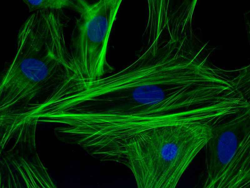 Fig.2 Actin filaments. (https://commons.wikimedia.org/wiki/File:F-actin_filaments_in_cardiomyocytes.jpg)