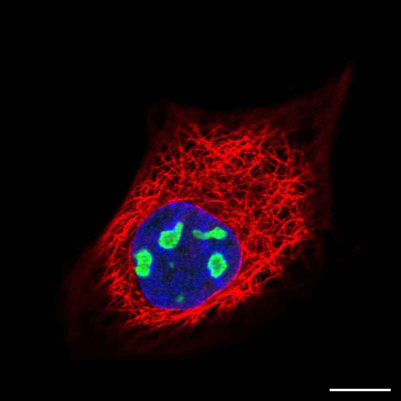 Fig.20 Nucleoli. (https://v18.proteinatlas.org/learn/dictionary/cell/nucleoli)