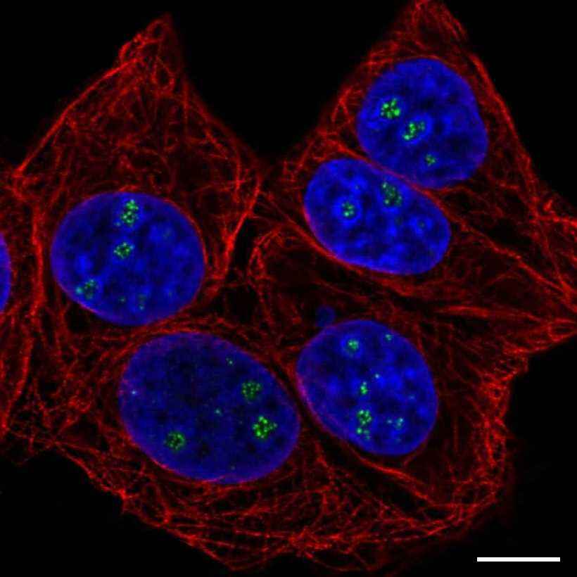 Fig.21 Nucleoli fibrillar center. (https://v18.proteinatlas.org/learn/dictionary/cell/nucleoli+6)