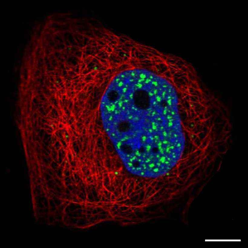 Fig.22 Nuclear speckles. (https://v18.proteinatlas.org/learn/dictionary/cell/nuclear+speckles)