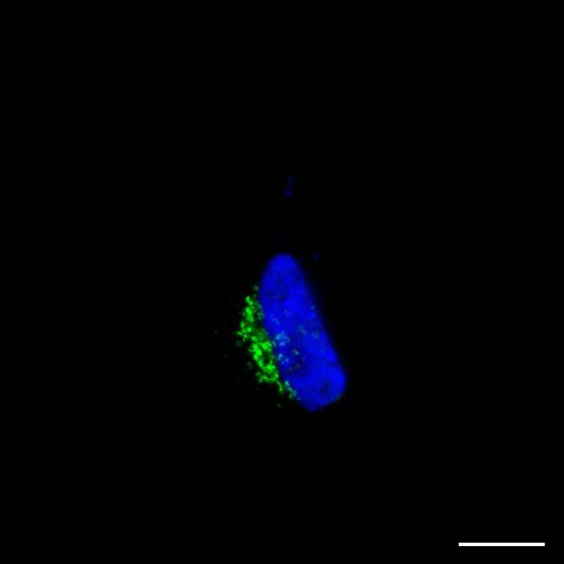 Fig.25 Golgi apparatus. (https://v18.proteinatlas.org/learn/dictionary/cell/golgi+apparatus)