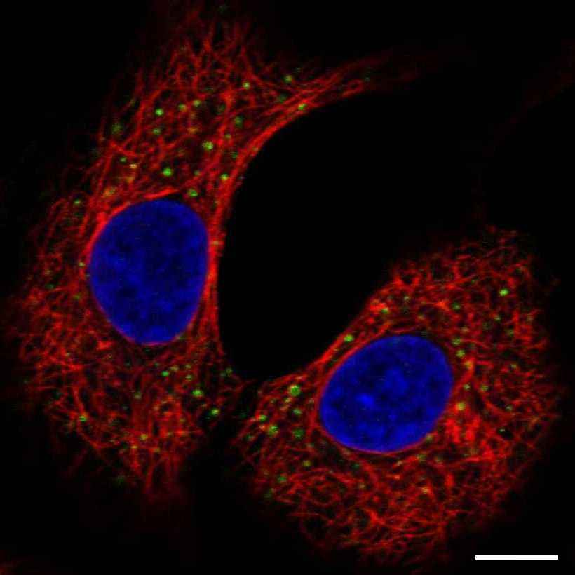Fig.28 Endosomes. (https://v18.proteinatlas.org/learn/dictionary/cell/vesicles+3)
