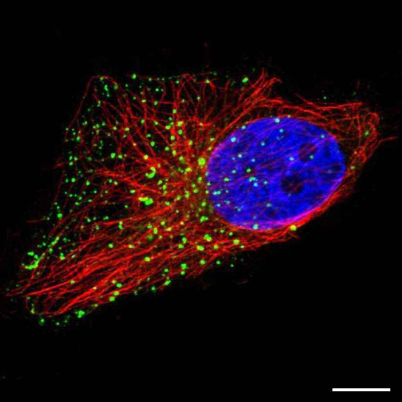 Fig.29 Lysosomes. (https://v18.proteinatlas.org/learn/dictionary/cell/vesicles+5)