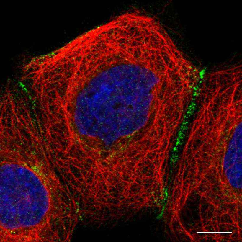 Fig.32 Cell junctions. (https://v18.proteinatlas.org/learn/dictionary/cell/cell+junctions+4)