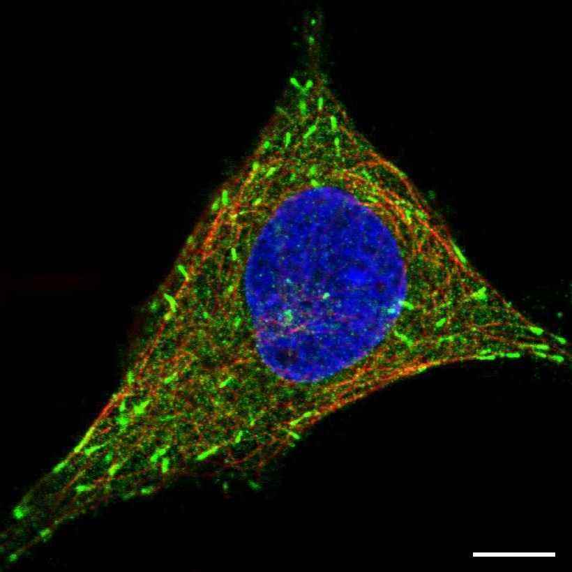 Fig.5 Microtubule ends. (https://v15.proteinatlas.org/learn/dictionary/cell/cytoskeleton+(microtubule+end))