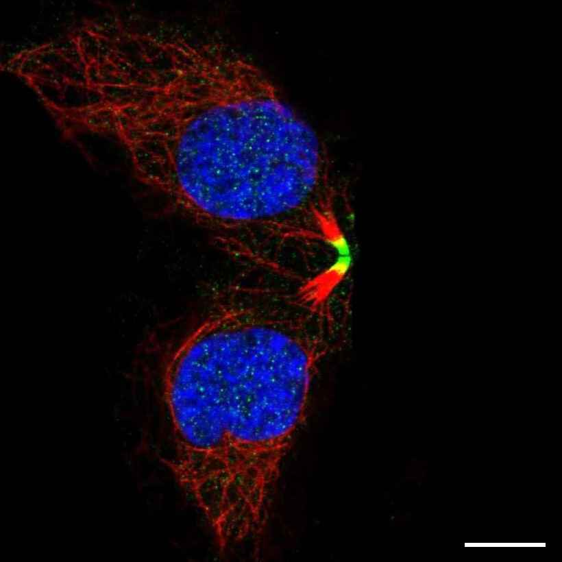Fig.7 Midbody. (https://v18.proteinatlas.org/learn/dictionary/cell/cytokinetic+bridge+4)
