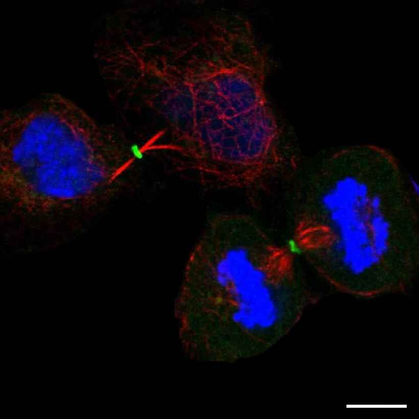 Fig.8 Midbody ring. (https://v18.proteinatlas.org/learn/dictionary/cell/cytokinetic+bridge+7)