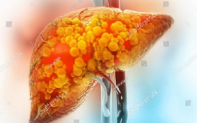 Metabolism Research