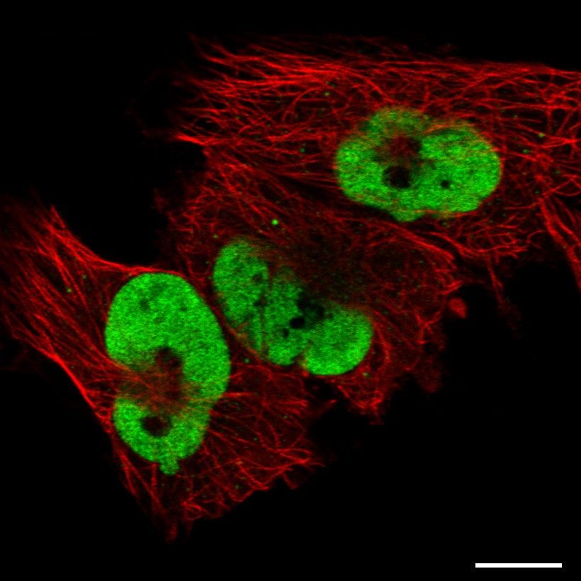 Fig.18 Nucleoplasm. (https://v18.proteinatlas.org/learn/dictionary/cell/nucleus+5)