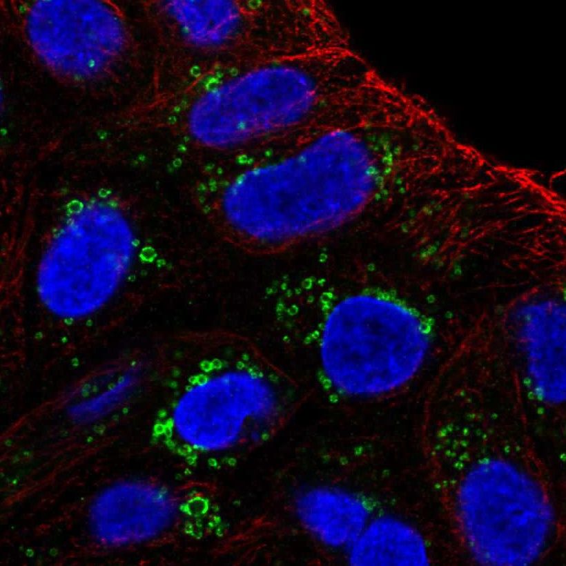 Fig.30 Lipid droplets. (https://v18.proteinatlas.org/learn/dictionary/cell/vesicles+9)