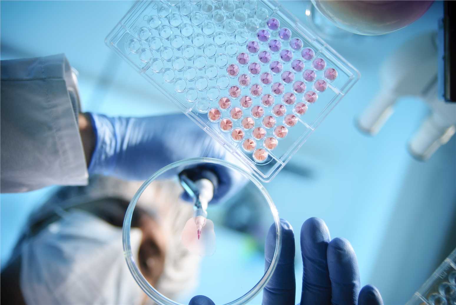 Fig.1 (Creative Biolabs Authorized)