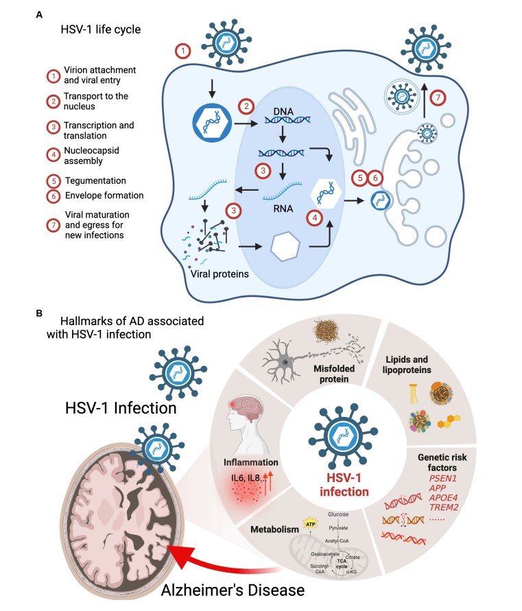 The Connection Between HSV-1 and Alzheimer's. (Feng, 2023)