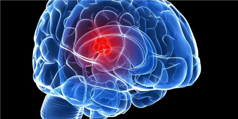 Glioma Overview - Signaling Pathway