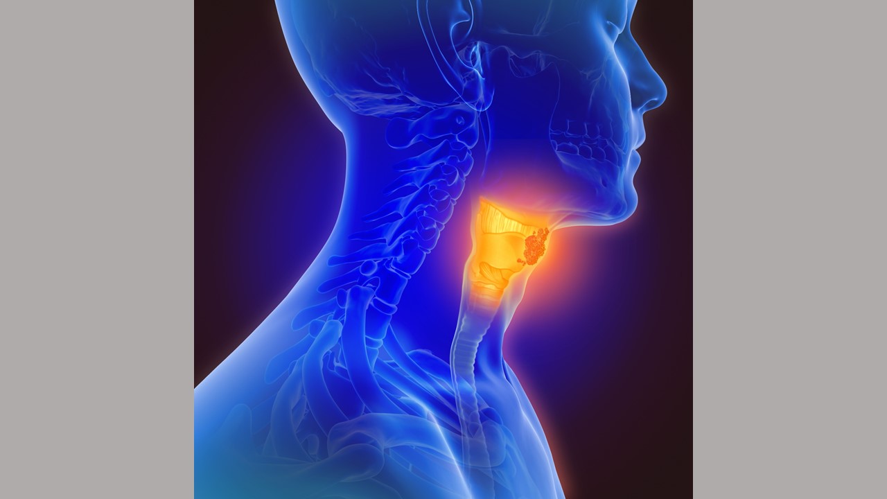 Head & Neck Cancer Overview - Signaling Pathway