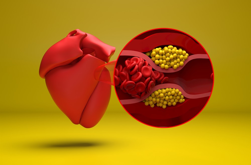 Myocardial infarction and heart failure research illustration for antibody selection (Creative Biolabs Authorized)
