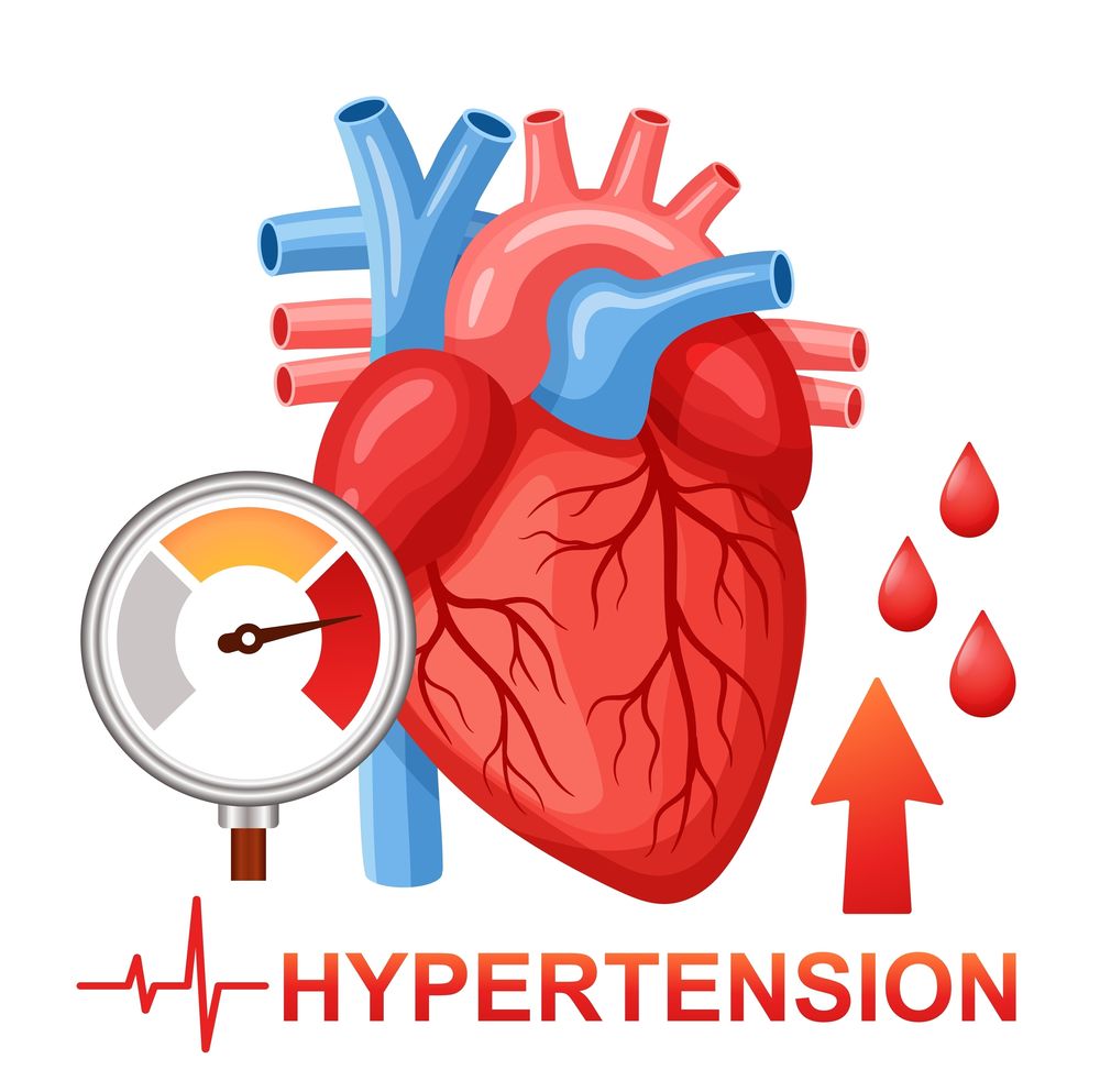 Hypertension and vascular remodeling research illustration for antibody target exploration (Creative Biolabs Authorized)