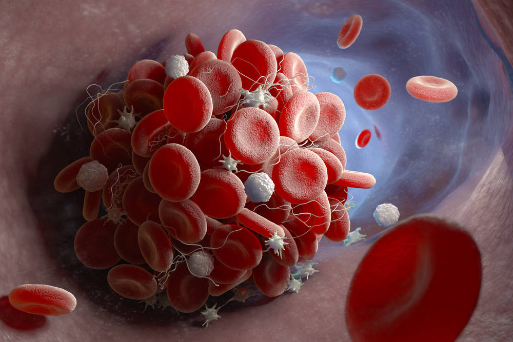 Thrombosis and hemostasis research illustration for antibody target exploration (Creative Biolabs Authorized)