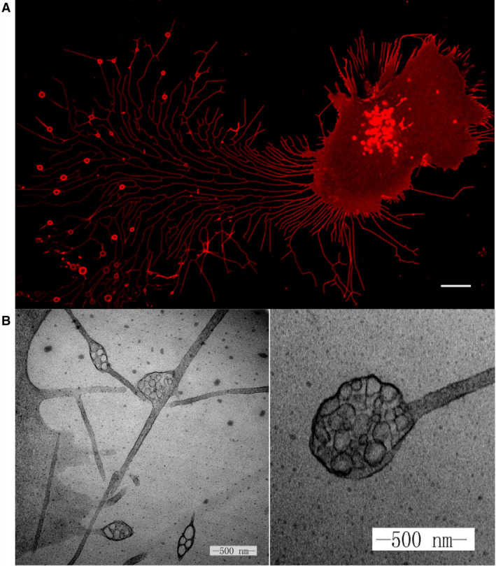 Migrasomes from L929 cells.