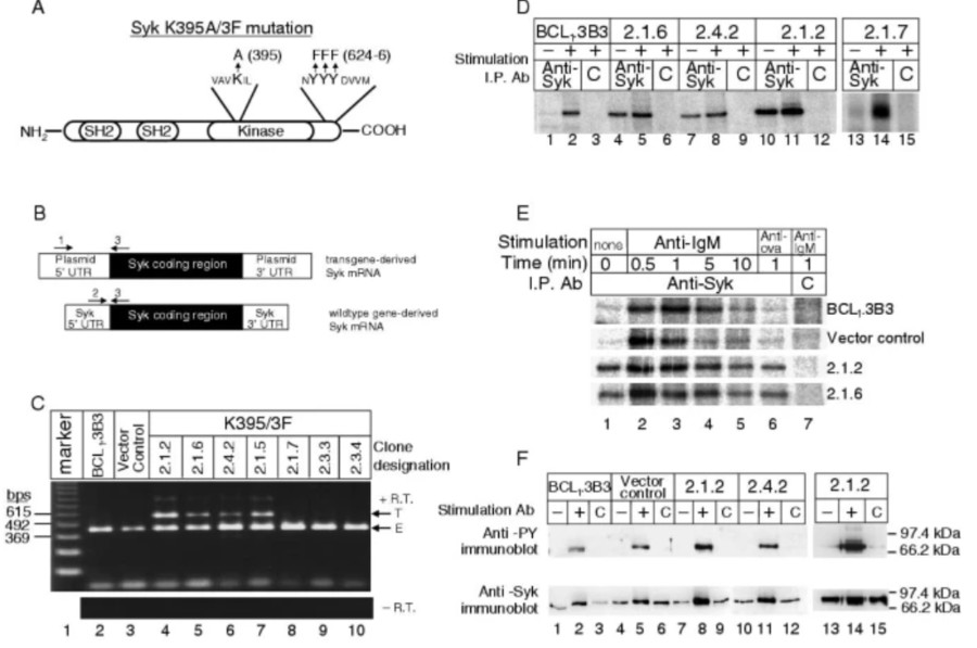Fig. 1:Expression of the (K395A/3F)Syk molecule is associated with constitutive Syk kinase activity. (OA Literature)