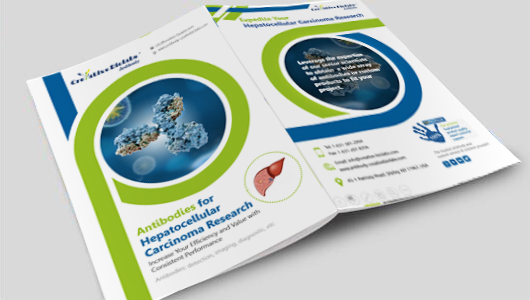 Antibodies for Hepatocellular Carcinoma Research