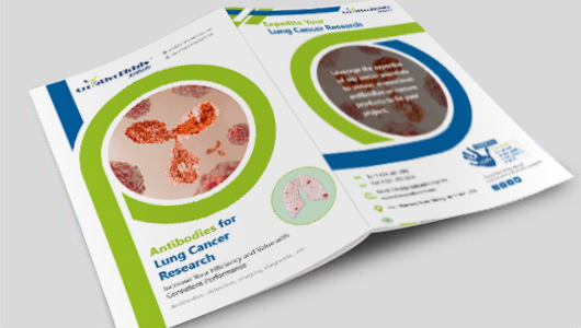 Antibodies for Lung Cancer Research