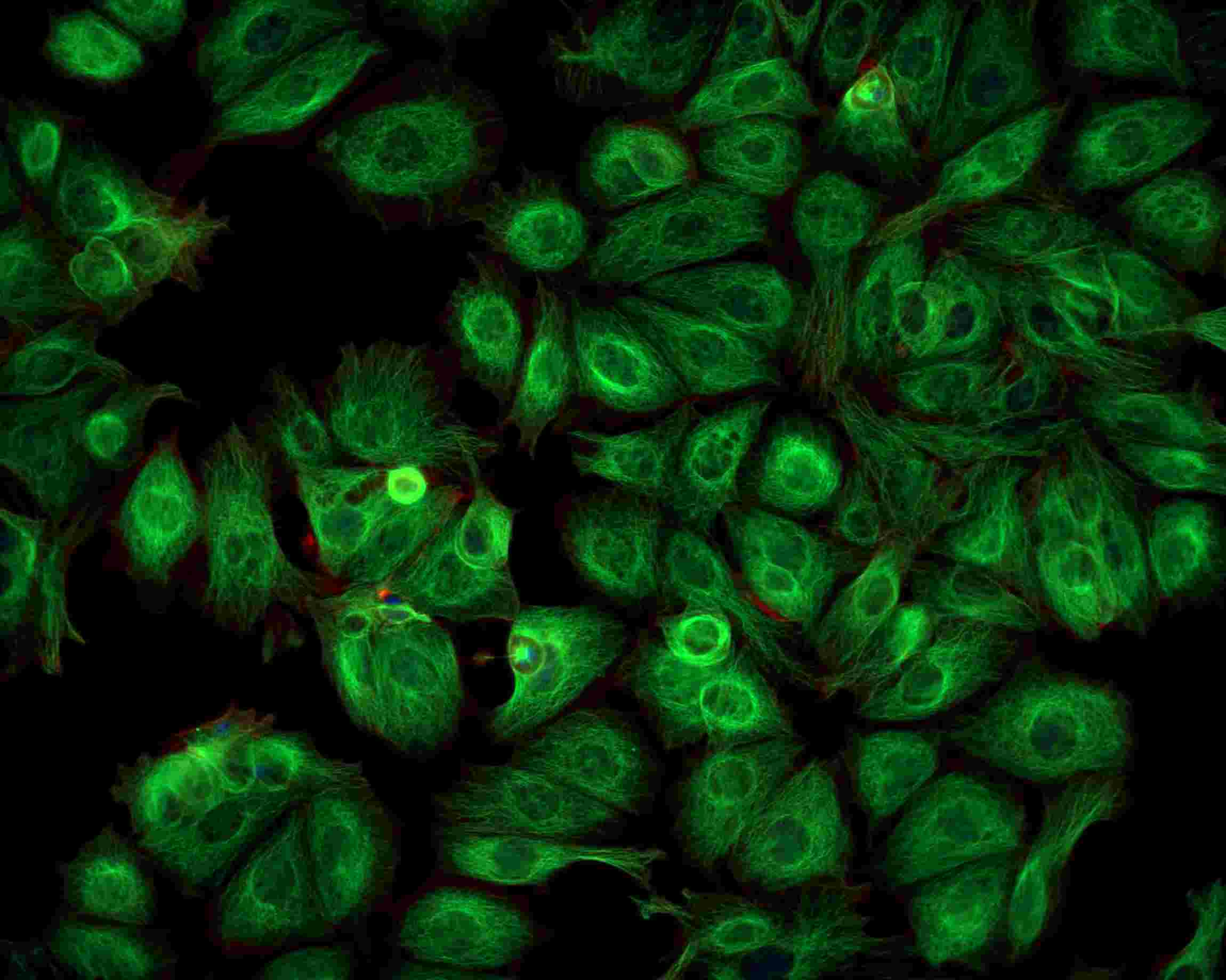 Immunofluorescence (IF)