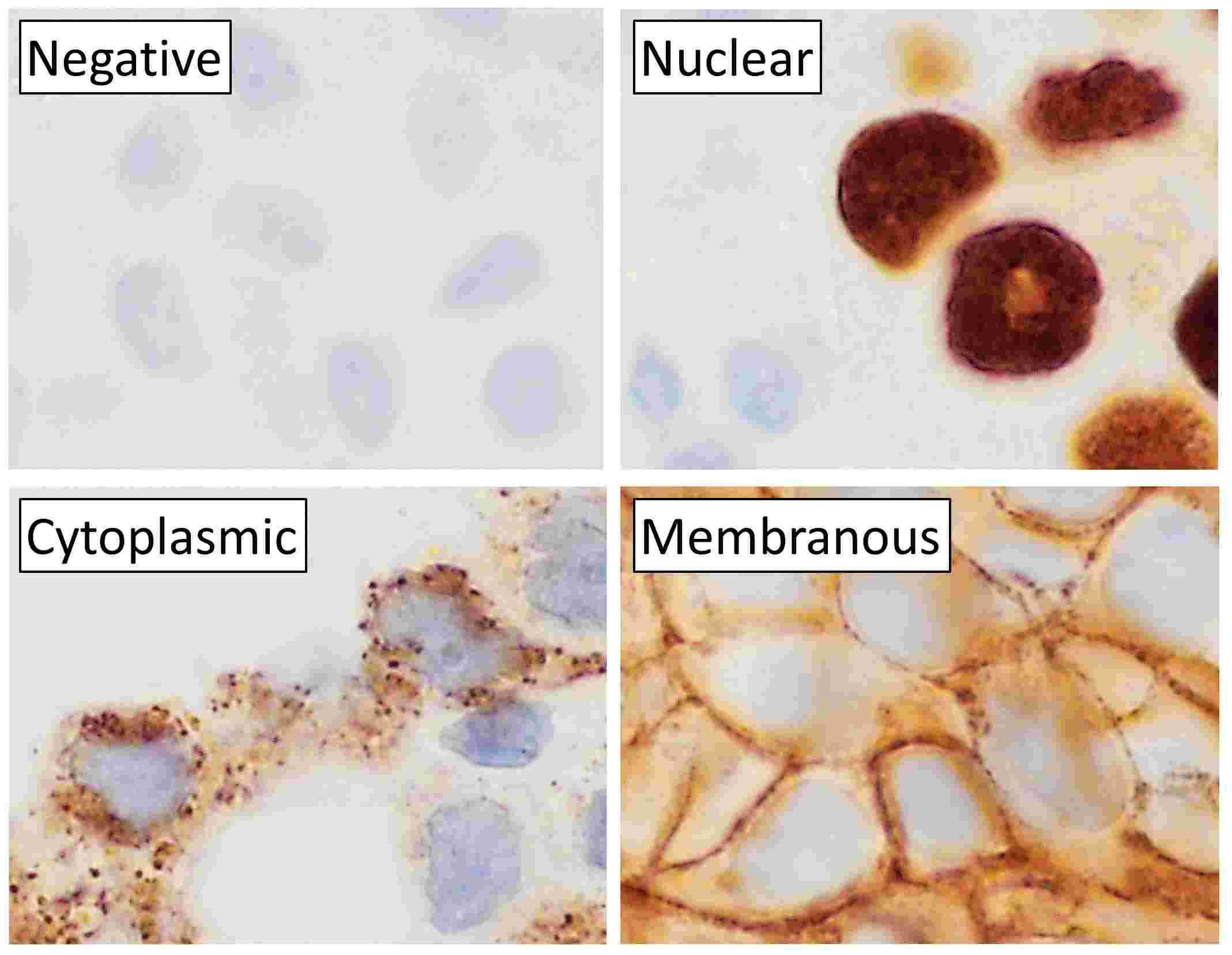 Immunohistochemistry (IHC)