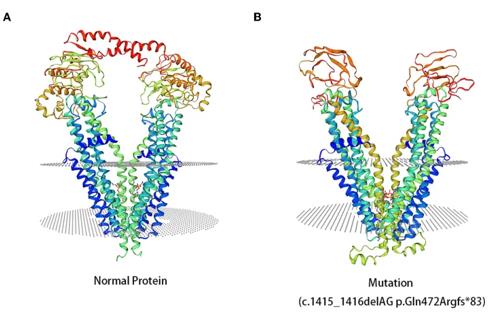 Fig. 1 3D computer model (SWISS-MODEL) shows the predicted structures of the ABCD1 protein. (OA Literature)