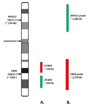 Fig. 1 Schematic of CBFB FISH Probe Sets (BAP/DF).