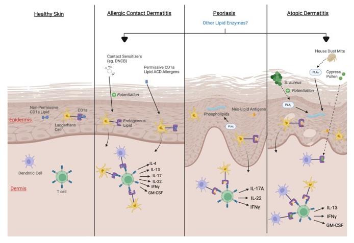 Fig. 1 Postulated mechanisms of CD1a involvement in inflammatory skin disease pathogenesis.