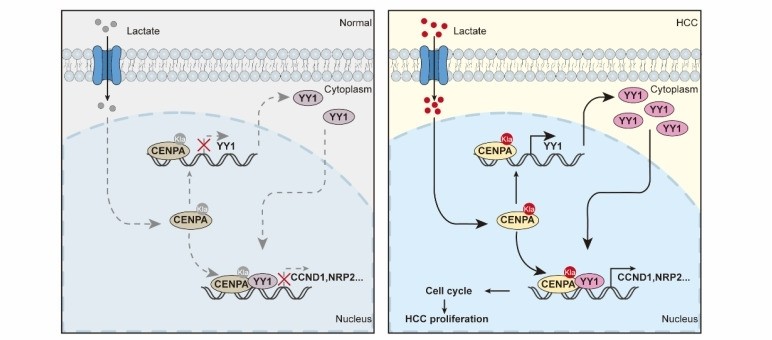 Fig. 1:CENPA Drives HCC Progression through Transcriptional Activation.