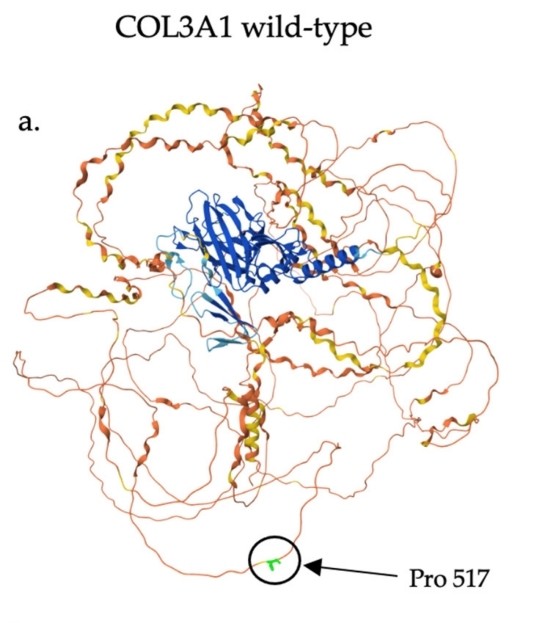 Fig. 1:Predicted structure of wild-type COL3A1, with proline 517 labeled.