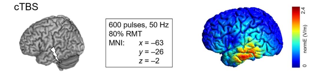 Fig. 1:Target Site and Simulated Electric Field of cTBS.