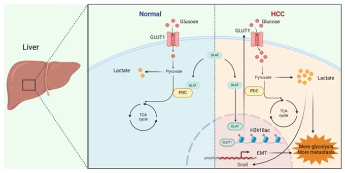 Fig. 1 DLAT Drives HCC Metastasis by Reprogramming Glycolysis and Inducing EMT.
