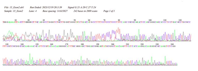 The sequence of HOXB13.