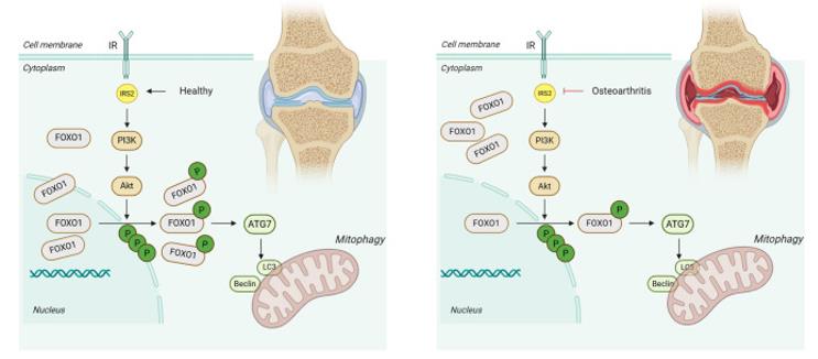 Fig. 1 The role of IRS2/FOXO1 signaling in chondrocyte autophagy and osteoarthritis progression.