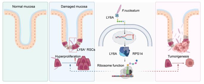Fig. 1 Fusobacterium nucleatum Targets LY6A⁺Resident Stem Cells to Promote Colorectal Cancer Initiation. (OA Literature)