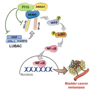 Fig. 1 Proposed model diagram of PI16 inhibition of NF-κB signalling pathway and BLCA metastasis. (OA Literature)