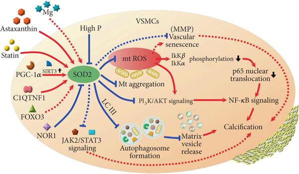Fig. 1:SOD2 regulatory network in vascular smooth muscle cells.