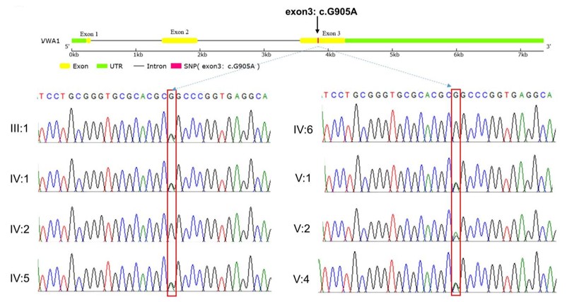 Fig. 1 Sanger sequencing results of the VWA1 mutation in the pedigree. (OA Literature)