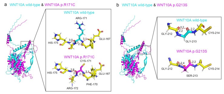 Fig. 1 Structural and H-Bond Analysis of WNT10A Wild-Type and Mutants (R171C, G213S). (OA Literature)